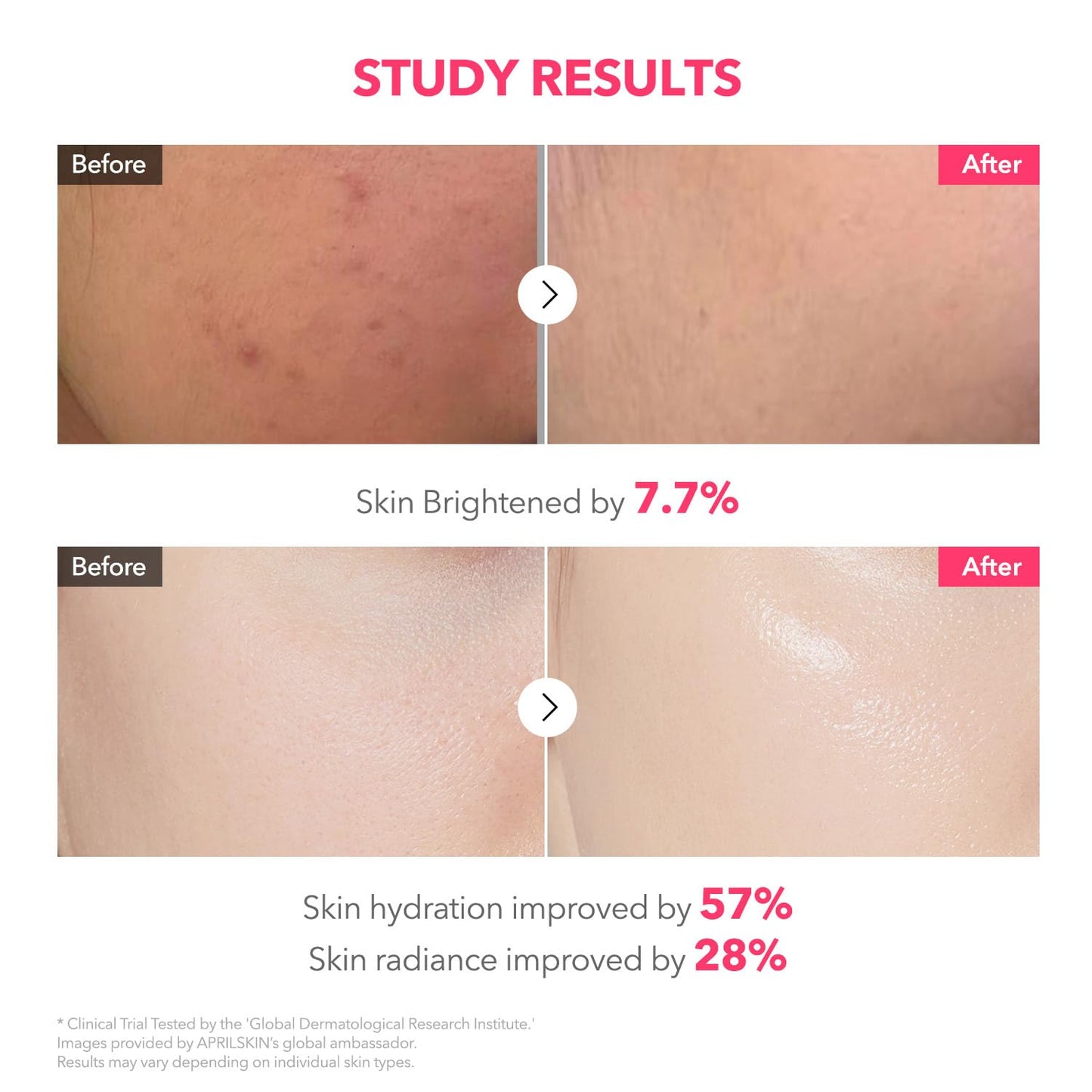 HOTAPRILSKIN TXA Pink Capsule Gel Mask | Overnight Face Mask for Glass Glow Skin I 99% High-Purity Tranexamic Acid 3 for uneven skin tone I Elasticity, Hydrating and Firming I Korean Skincare I 30g x 4ea