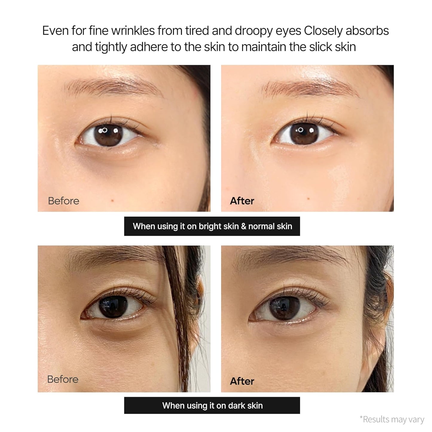 HOTDr.Melaxin Calcium Dark Spot Eye Cream 15g – Niacinamide & Calcium Gluconate Eye Cream for Dark Circles, Under Eye Bags & Sagging | Hydrolyzed Elastin EX Volume Firming | Korean Eye Cream