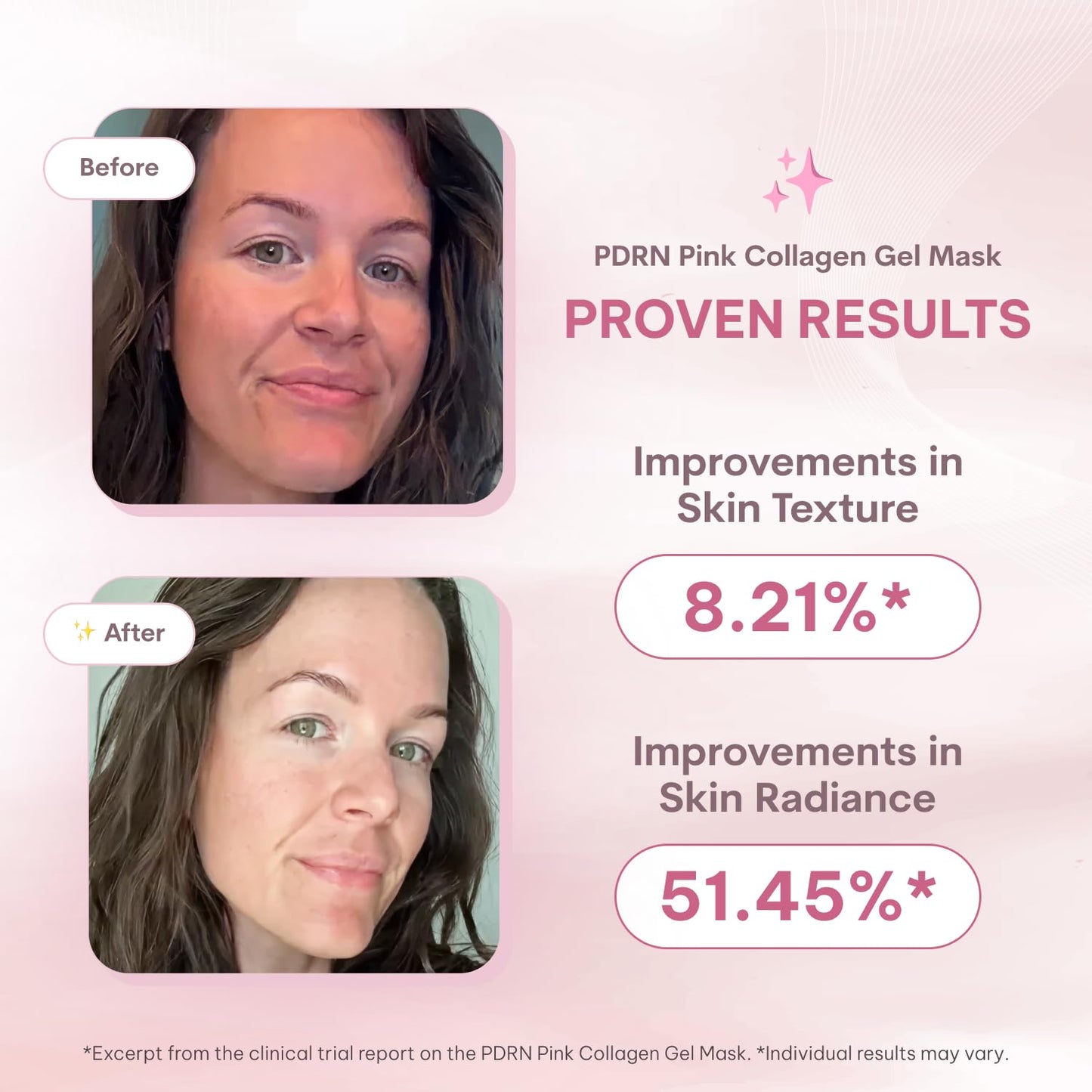 HOTQuasi Salmon PDRN Collagen Mask – Korean Skin care Gel Face Mask for Hydration, Firming & Smoothing Skincare, Collagen Boost & Pore Care – 4 Masks, Non-Irritating, Natural Ingredients