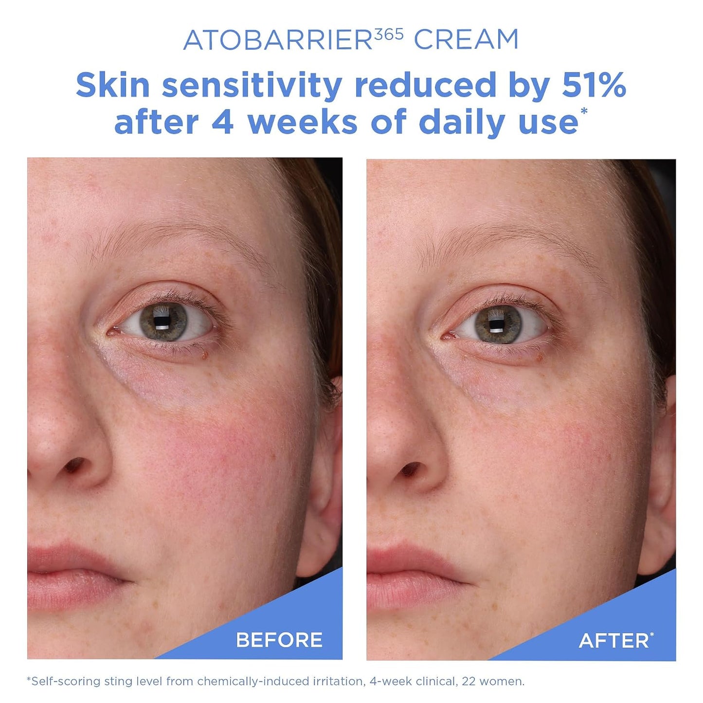 HOTAESTURA ATOBARRIER365 Cream with Ceramides, Korean Face Moisturizer for Barrier Repair | 120H lasting Hydration, Ceramide Capsules, Dry & Sensitive Skin, Non-comedogenic, 80 mL / 2.70 fl.oz.