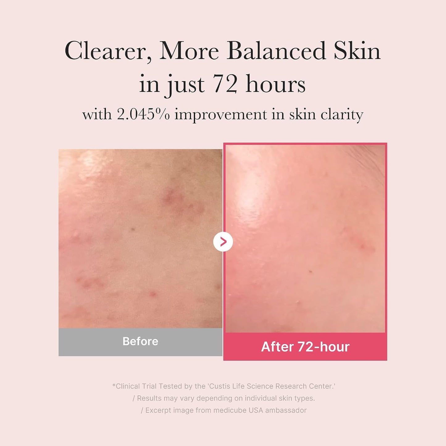 HOTmedicube TXA&Niacinamide 15% Glow Serum | Lightweight Daily Serum - For Uneven Skin Tone, Texture, and After Spot Care, High-Potency Tranexamic Acid 5%, 1.01 fl.oz