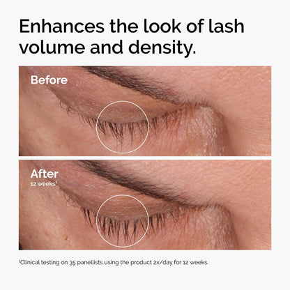 HOTThe Ordinary Multi-Peptide Lash and Brow Serum, Peptide-Powered Formula for Thicker, Fuller Looking Lashes & Brows