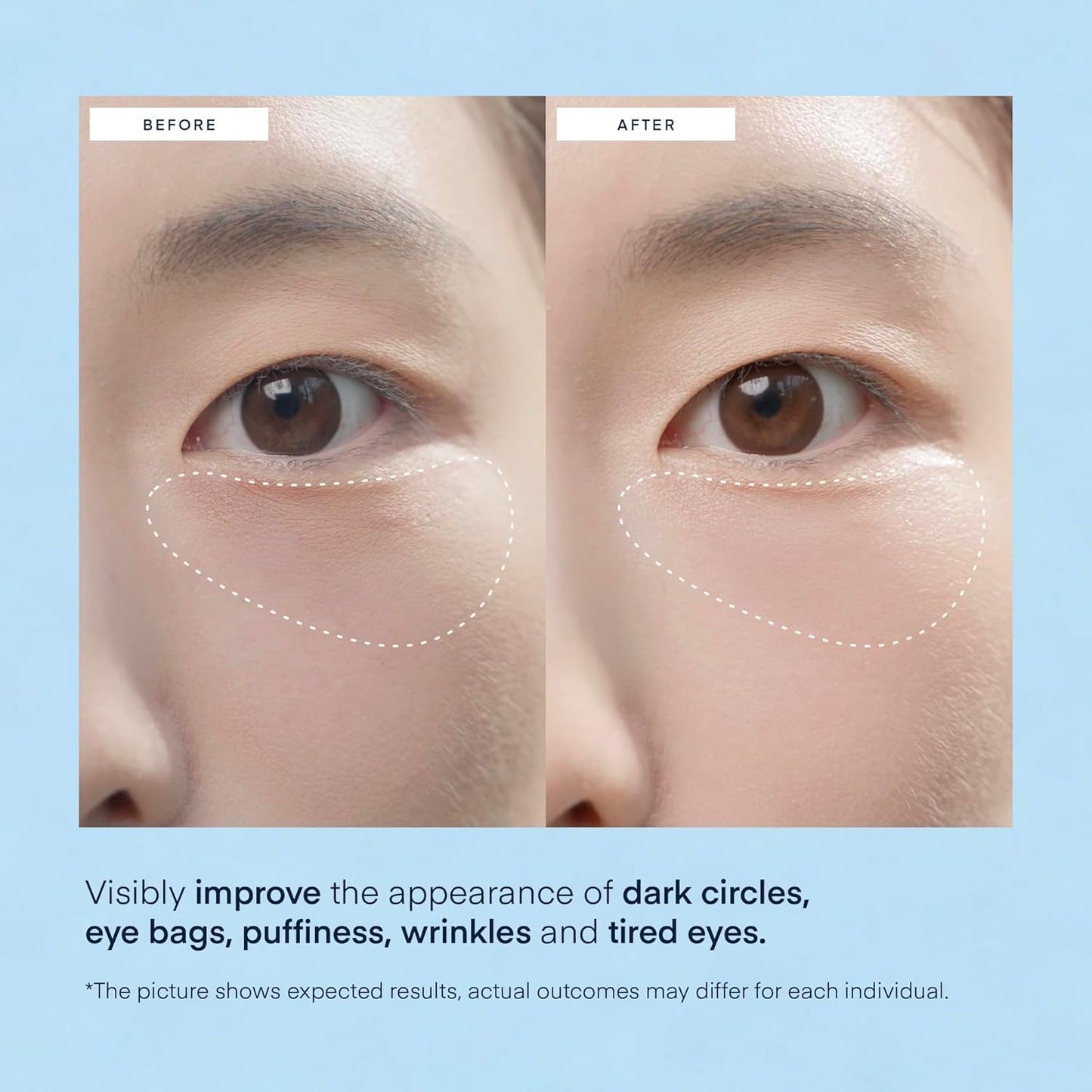 HOTTerez & Honor Under Eye Patches for Dark Circles - 60 Korean Hydrogel Masks for Puffiness, Bags, Wrinkle with Caffeine, Hyaluronic Acid, Niacinamide - Undereye Hydrating & Cooling, Vegan, No Fragrance