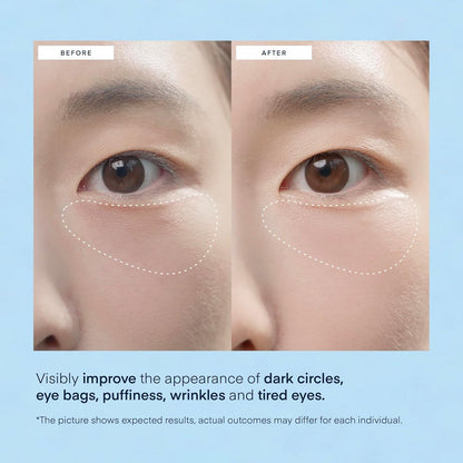 HOTTerez & Honor Under Eye Patches for Dark Circles - 60 Korean Hydrogel Masks for Puffiness, Bags, Wrinkle with Caffeine, Hyaluronic Acid, Niacinamide - Undereye Hydrating & Cooling, Vegan, No Fragrance