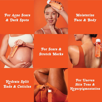 HOTBio-Oil Skincare Body Oil Serum, Scars & Stretch Marks, 2 fl oz | Dermatologist Recommended, Vitamin E & A, Dry & Sensitive Skin, Non-Comedogenic, Face and Body, Scar Treatment