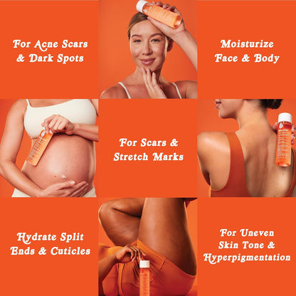 HOTBio-Oil Skincare Body Oil Serum, Scars & Stretch Marks, 6.7 fl oz | Dermatologist Recommended, Vitamin E & A, Dry & Sensitive Skin, Non-Comedogenic, Face and Body, Scar Treatment