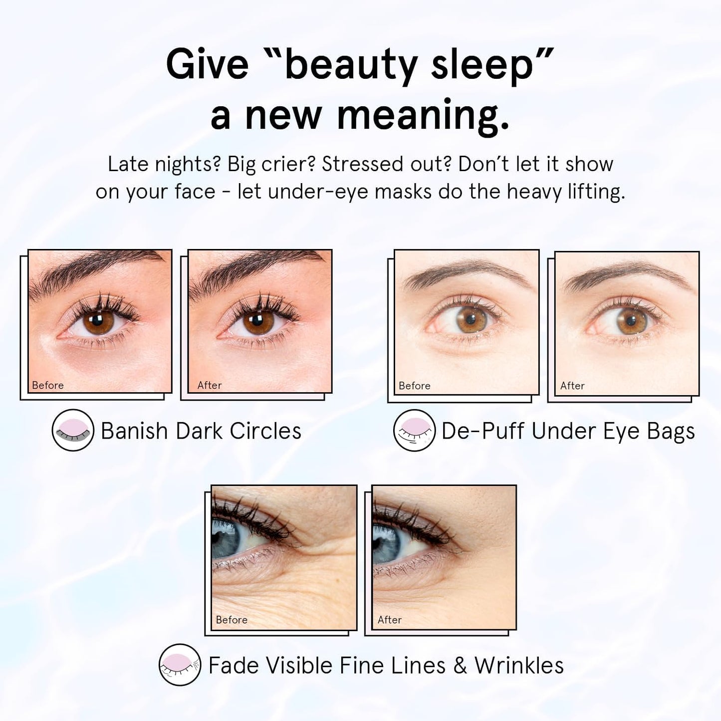 HOTgrace & stella Retinol Under Eye Patches for Puffy Eyes & Dark Circles - Restoring Gel Under Eye Masks with Hyaluronic Acid - Birthday Gifts for Women, Bachelorette Party Favors (Purple, 24 Pairs)