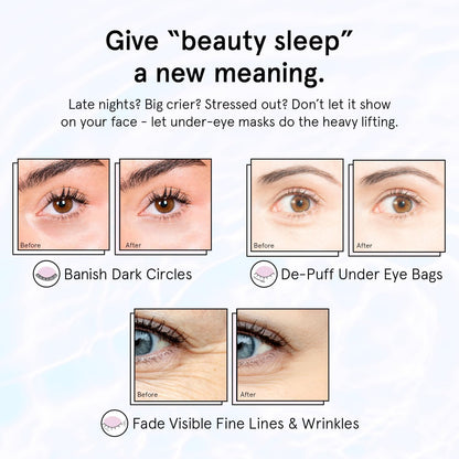 HOTgrace & stella Retinol Under Eye Patches for Puffy Eyes & Dark Circles - Restoring Gel Under Eye Masks with Hyaluronic Acid - Birthday Gifts for Women, Bachelorette Party Favors (Purple, 24 Pairs)