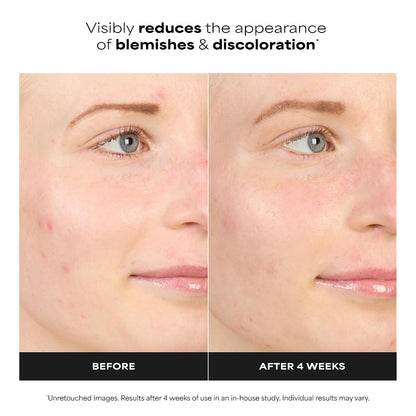 HOTPaula's Choice BOOST 10% Azelaic Acid Booster Cream Gel Face Serum with Salicylic Acid, Minimizes Look of Redness & Fades Discoloration, Oil-Free Skin Brightening Serum for Face, Fragrance-Free