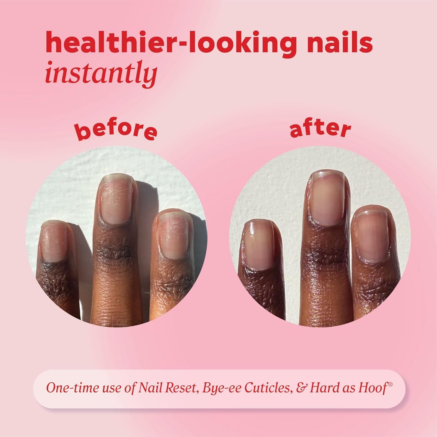 HOTOnyx Professional Hard as Hoof Nail Strengthening Cream, Island Coconut Scent - Nail Growth and Conditioning Cuticle Cream Stops Splits, Chips, Cracks & Strengthens Nails, 1 oz