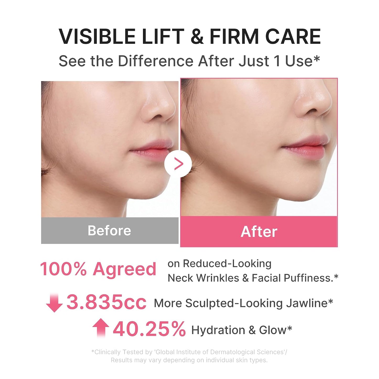 HOTmedicube PDRN Collagen Gua Sha Neck Wrinkle Cream - Firming, Contour Care | Built-In Gua Sha Massager with Volufiline 5% - For the Look of Fine Lines, Jawline, Neck, Décolleté, Korean Skincare, 3.17 oz