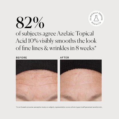 HOTNaturium Azelaic Topical Acid 10%, Face & Skin Care Beauty Treatment with Niacinamide & Vitamin C, 1 oz