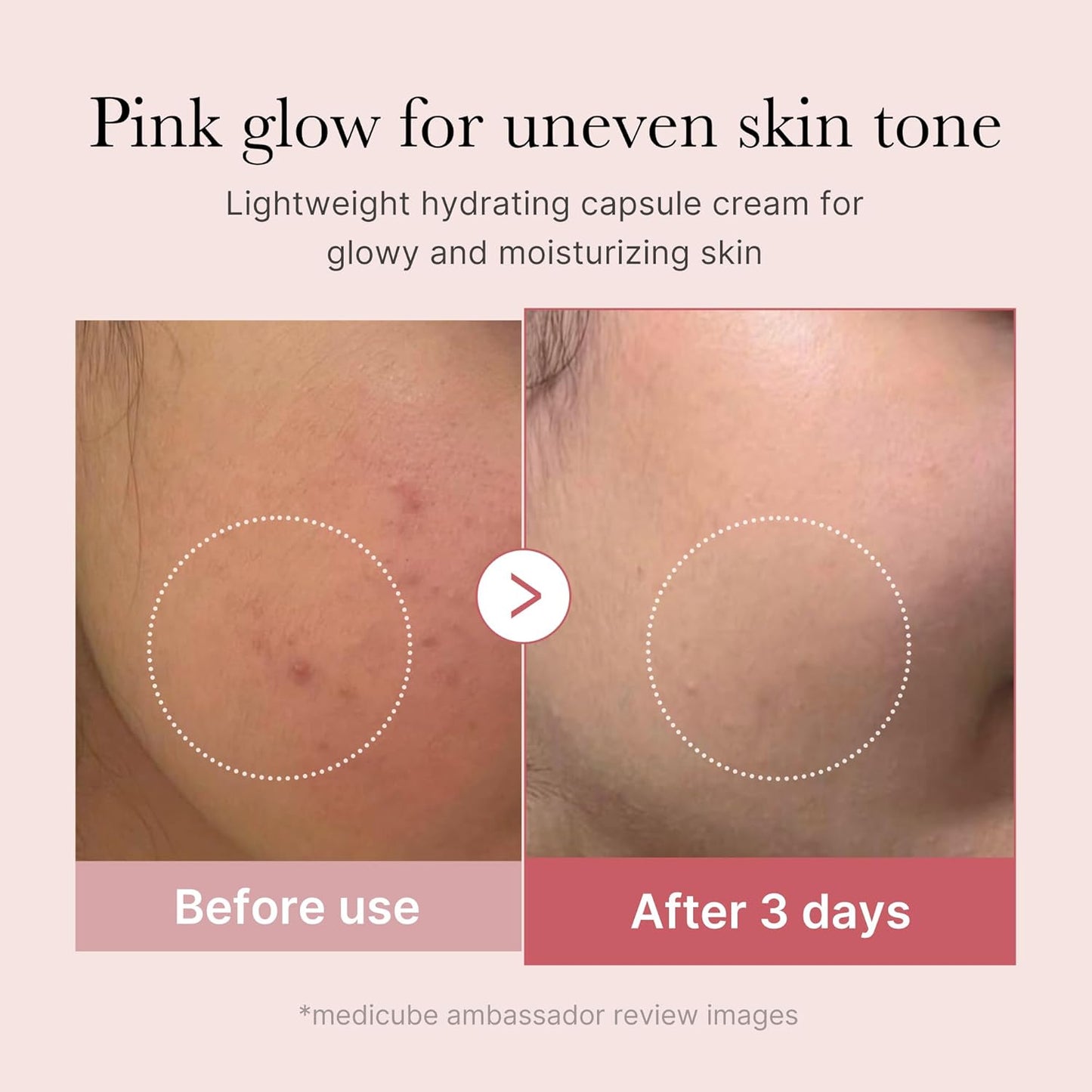 HOTmedicube Capsule Cream with Salmon DNA PDRN Pink Collagen | Lightweight Moisturizing Cream with PDRN, Niacinamide for Uneven Skin Tone and Texture, Glow hydration | Korean Skincare, 1.94 oz