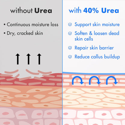 HOTEbanel Urea Cream 40% plus Salicylic Acid 2% for Dry Cracked Feet Skin | Deeply Moisturizes & Softens Dry Cracked Heels, Feet, Knees, Elbows, Hands, Rough Dead Skin Callus Remover Toenail Softener