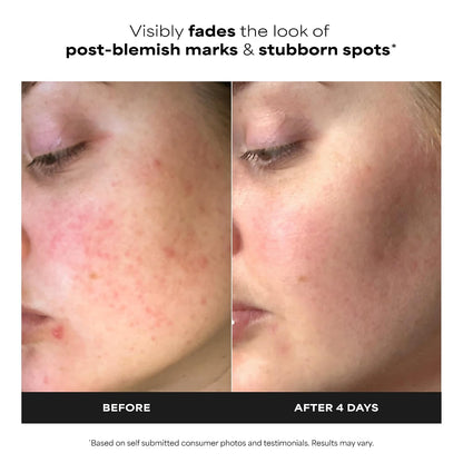HOTPaula's Choice BOOST 10% Azelaic Acid Booster Cream Gel Face Serum with Salicylic Acid, Minimizes Look of Redness & Fades Discoloration, Oil-Free Skin Brightening Serum for Face, Fragrance-Free