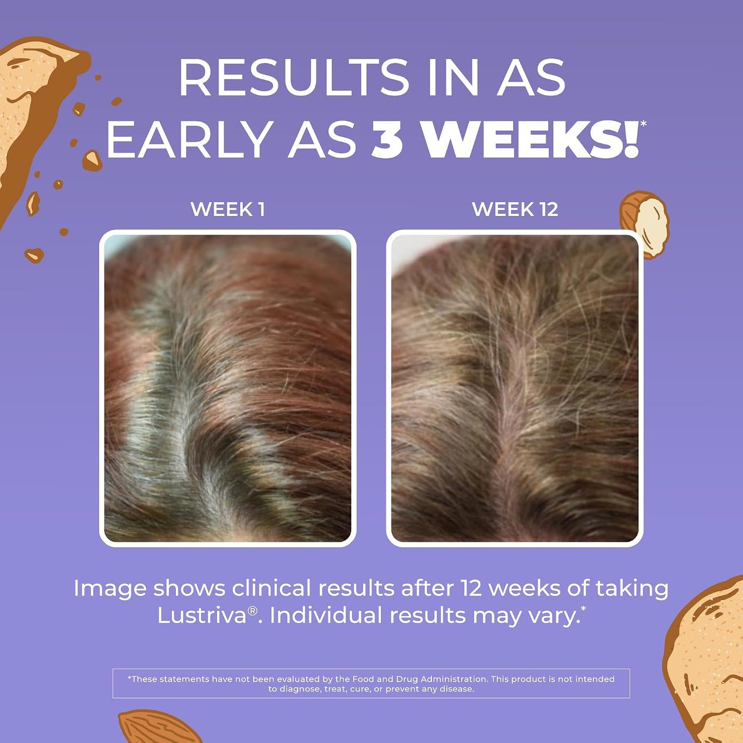 HOTMaryRuth's Hair Growth Max Liposomal 10000mcg Biotin, Thicker Hair, 15.22oz | Lustriva® + Biotin 10000mcg + Pumpkin Seed Oil, Thicker Hair, Hair Care, Wrinkles, Fine Lines, Skin Care, Ages 18+