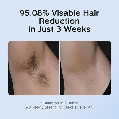 HOTINNZA IPL Hair Removal with Ice Cooling Care Function for Women,Long-Lasting Results,999,999 Flashes Painless Hair Removal, Hair Removal Device for Armpits Legs Arms Bikini Line