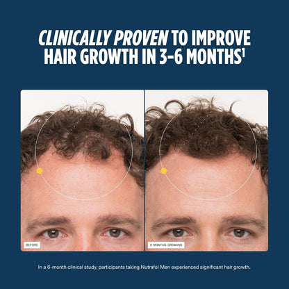 HOTNutrafol Men's Hair Growth Supplements, Clinically Tested for Visibly Thicker Hair and Scalp Coverage, Dermatologist Recommended - 1 Month Supply