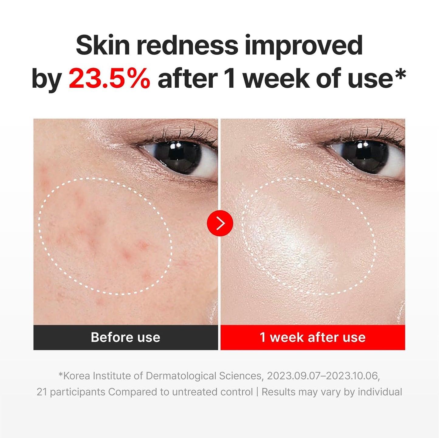 HOTCENTELLIAN 24 Madeca Cream Time Reverse - Firming Face Moisturizer with TECA Centella Asiatica, Skin Elasticity & Barrier Support, Deep Hydration Anti-Aging Face Cream, Korean Skincare, 1.69 fl oz