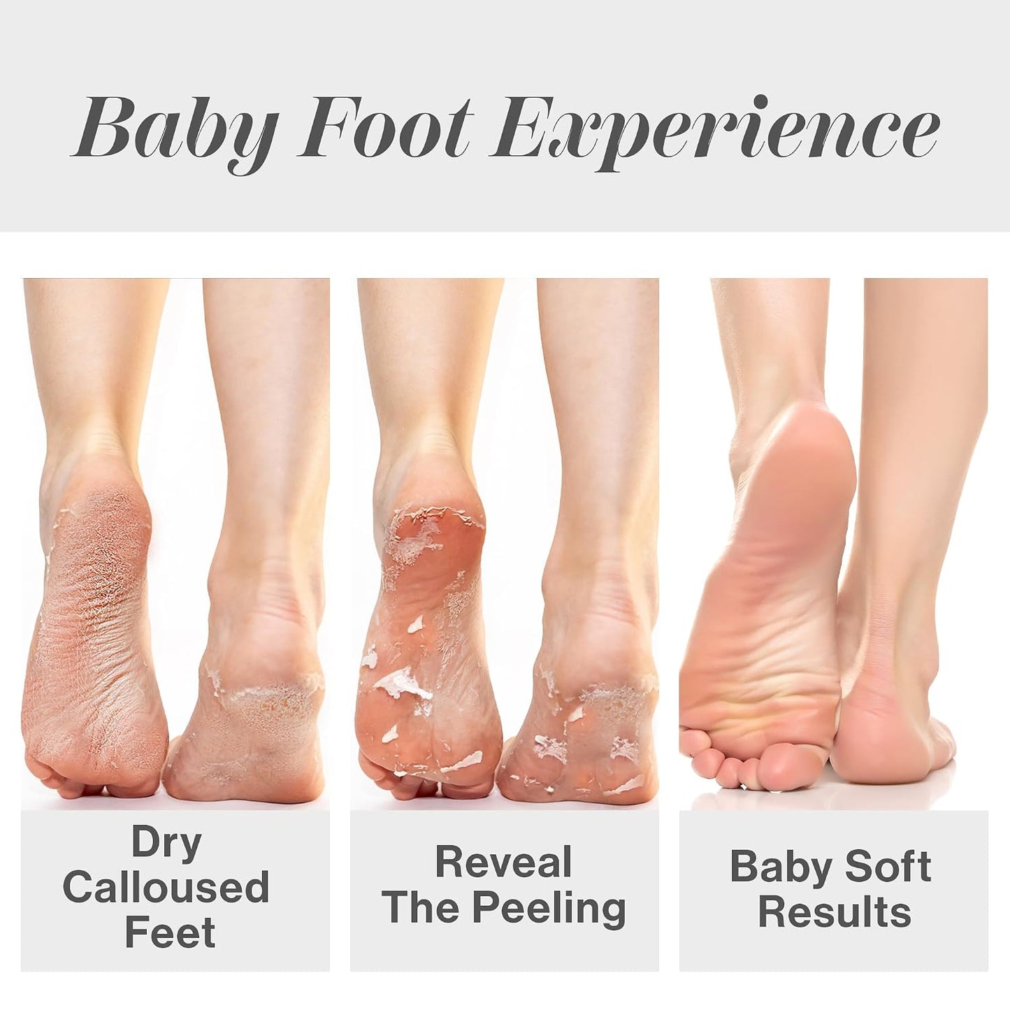 HOTBaby Foot Original Exfoliation Foot Peel - For Rough Cracked, Dry Feet, Dead Skin Removal - Foot Peeling Mask for Baby Soft Feet - Spa Experience at Home & Gift Ideas - Lavender Scented