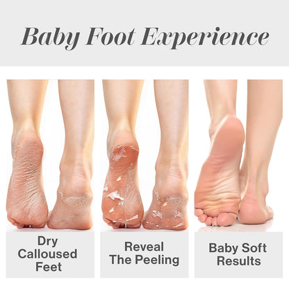HOTBaby Foot Original Exfoliation Foot Peel - For Rough Cracked, Dry Feet, Dead Skin Removal - Foot Peeling Mask for Baby Soft Feet - Spa Experience at Home & Gift Ideas - Lavender Scented