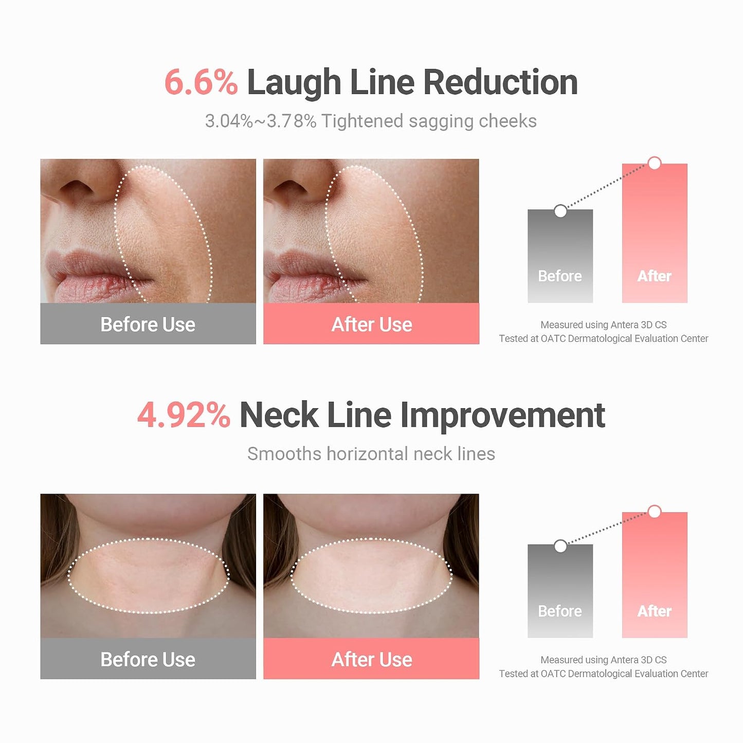 HOTKAHI Wrinkle Bounce Multi Balm Stick | PDRN Collagen Wrinkle Stick | Korean Skin Care |All-in-One Hydrating Lip Balm Eye Cream Neck Cream Make Up Base & Face Mist Moisture Balm