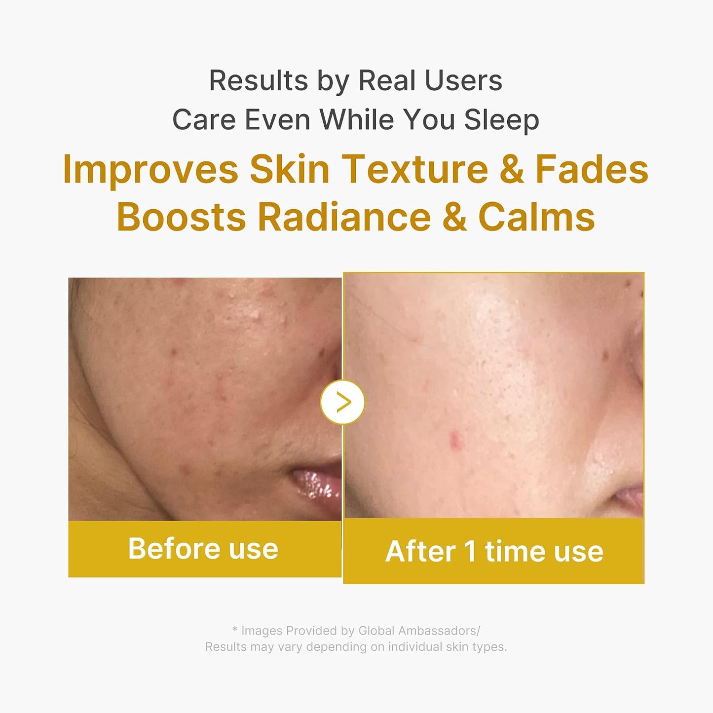 HOTmedicube Wrapping Mask Kojic Acid, Turmeric, Vitamin C Overnight Peel Off Facial Mask | Brighten & Defends Against Skin Stress for a Clear, Glowing Complexion | Korean Skin Care, 2.53 fl.oz