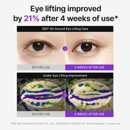 HOTCENTELLIAN 24 360º Shot PDRN Eye Cream - Anti-Aging Retinol Eye Cream with TECA, Collagen, Firming & Wrinkle Smoothing, Hydrating Care for Dark Circles, Under-Eye Bags & Crow's Feet, 1.01 fl oz