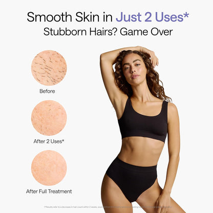 HOTUlike Laser Hair Removal Device Air 10 Ipl Gift for Women and Men, Ice cool and Permanent hair Reduction for Nearly Painless, Dual Lights, Skin Sensor & USHR Mode Hair Removal in 10mins from Home