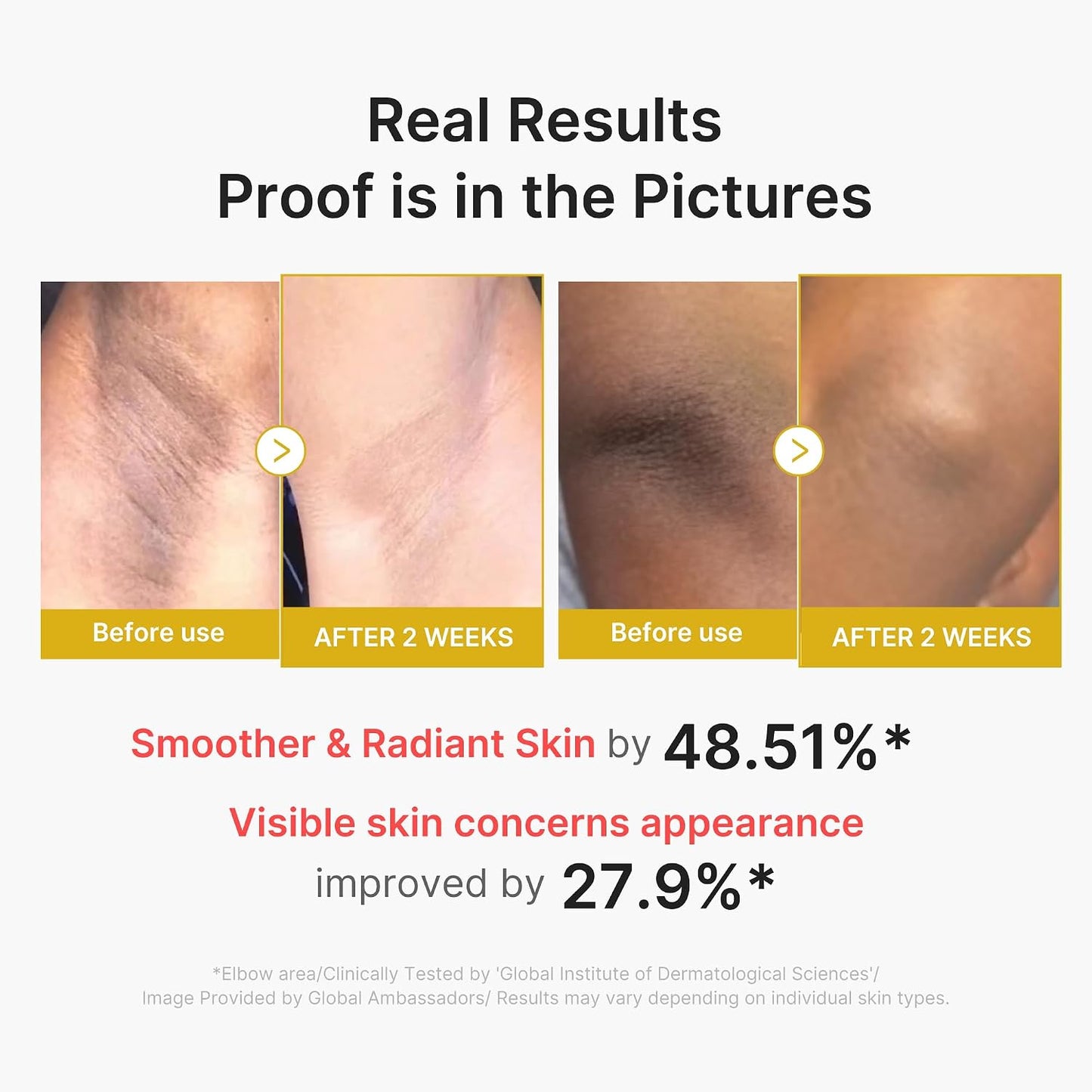 HOTmedicube Body Peel Shot with Kojic Acid and Turmeric | Gentle Body Brightening & Exfoliating Serum with BHA, LHA & PHA for Dead Skin Cells, Uneven Looking Skin & Excess Sebum | 9.46 fl.oz