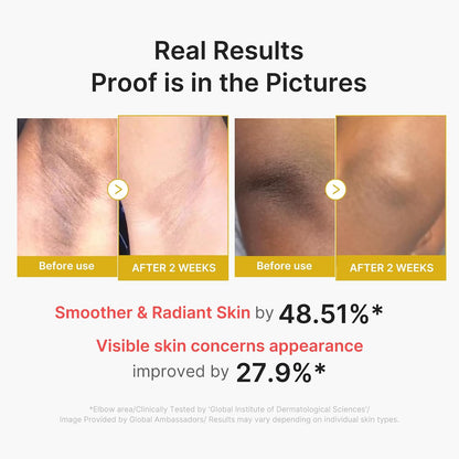 HOTmedicube Body Peel Shot with Kojic Acid and Turmeric | Gentle Body Brightening & Exfoliating Serum with BHA, LHA & PHA for Dead Skin Cells, Uneven Looking Skin & Excess Sebum | 9.46 fl.oz