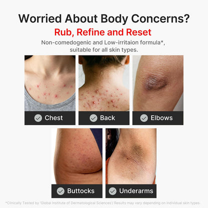 HOTmedicube Body Peel Shot with Kojic Acid and Turmeric | Gentle Body Brightening & Exfoliating Serum with BHA, LHA & PHA for Dead Skin Cells, Uneven Looking Skin & Excess Sebum | 9.46 fl.oz