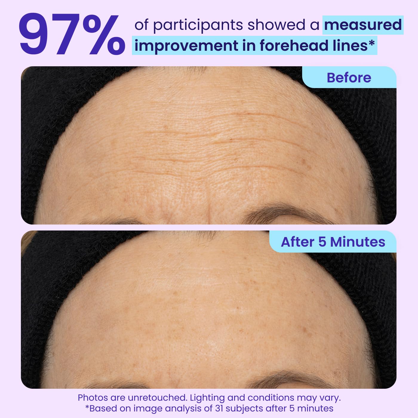 HOTgoPure NEW Instant Lift Eye Gel - For the look of Puffiness & Bags, Wrinkles, Fine Lines and Dark Circles, Anti Aging Skin Care for Men & Women with MaxLift3 Biotech Under Eye Brightener
