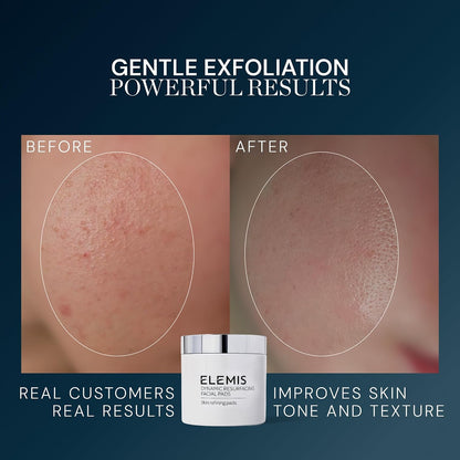 HOTELEMIS Dynamic Resurfacing Facial Pads, Gentle Textured Treatment Facial Exfoliating Pads