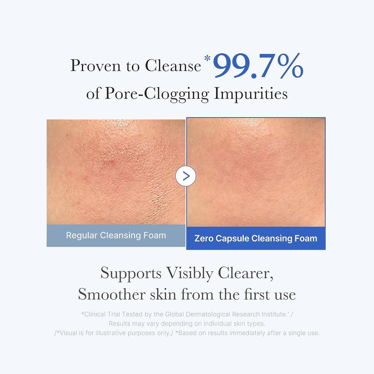 HOTmedicube Facial Cleanser Zero Pore Capsule Cleansing Foam | Daily Gentle Cleanser for Skin Texture, Blackhead & Pore Care - AHA, BHA & PHA for Deep Cleansing, Korean Skincare, 4.23 oz