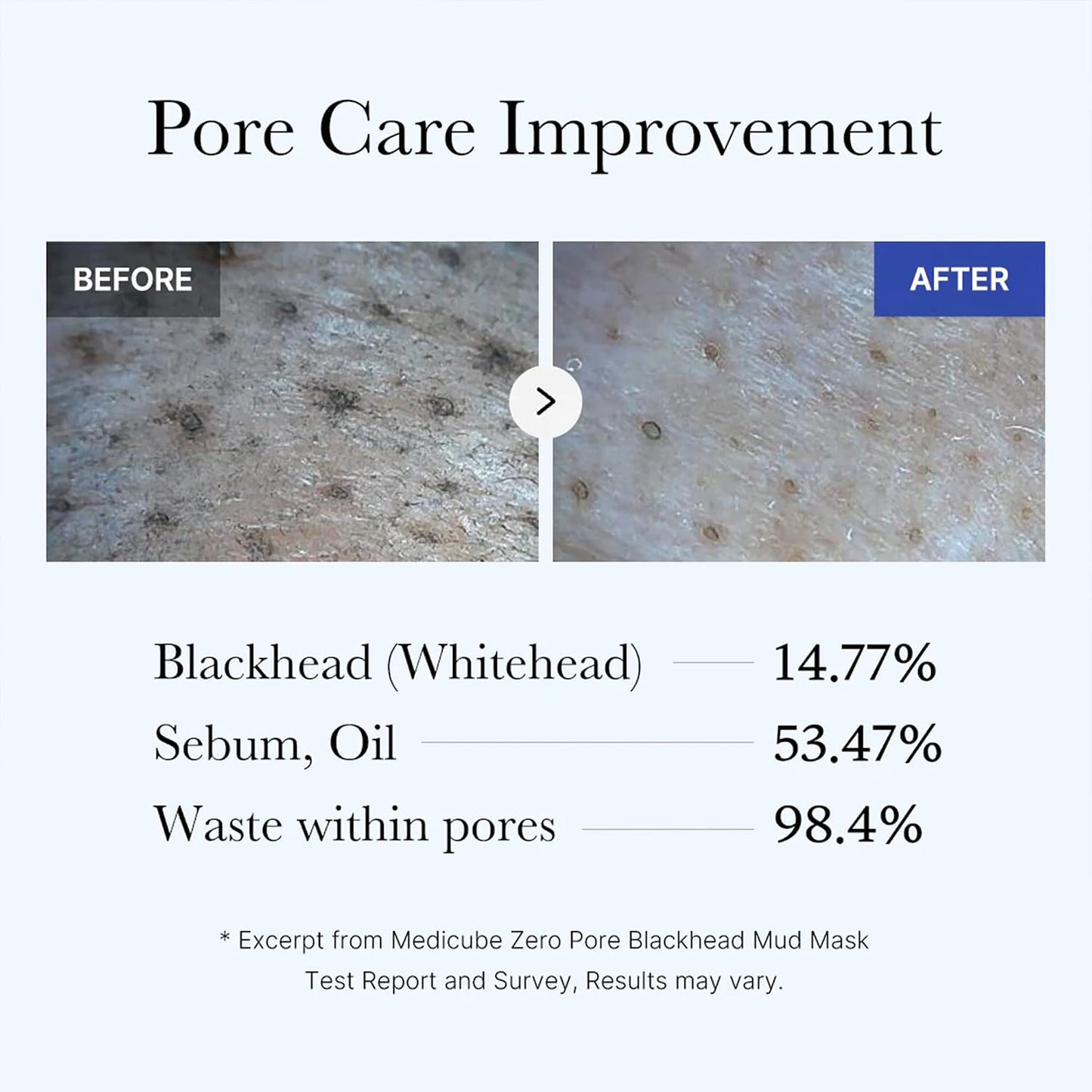 HOTmedicube Zero Pore Blackhead Mud Facial Mask - Skin Cooling & Pore Tightening - 3 Minute Quick Dry Formula with AHA, BHA, PHA, and Pore-Purifying Clay - Korean Mud Mask 3.52 oz