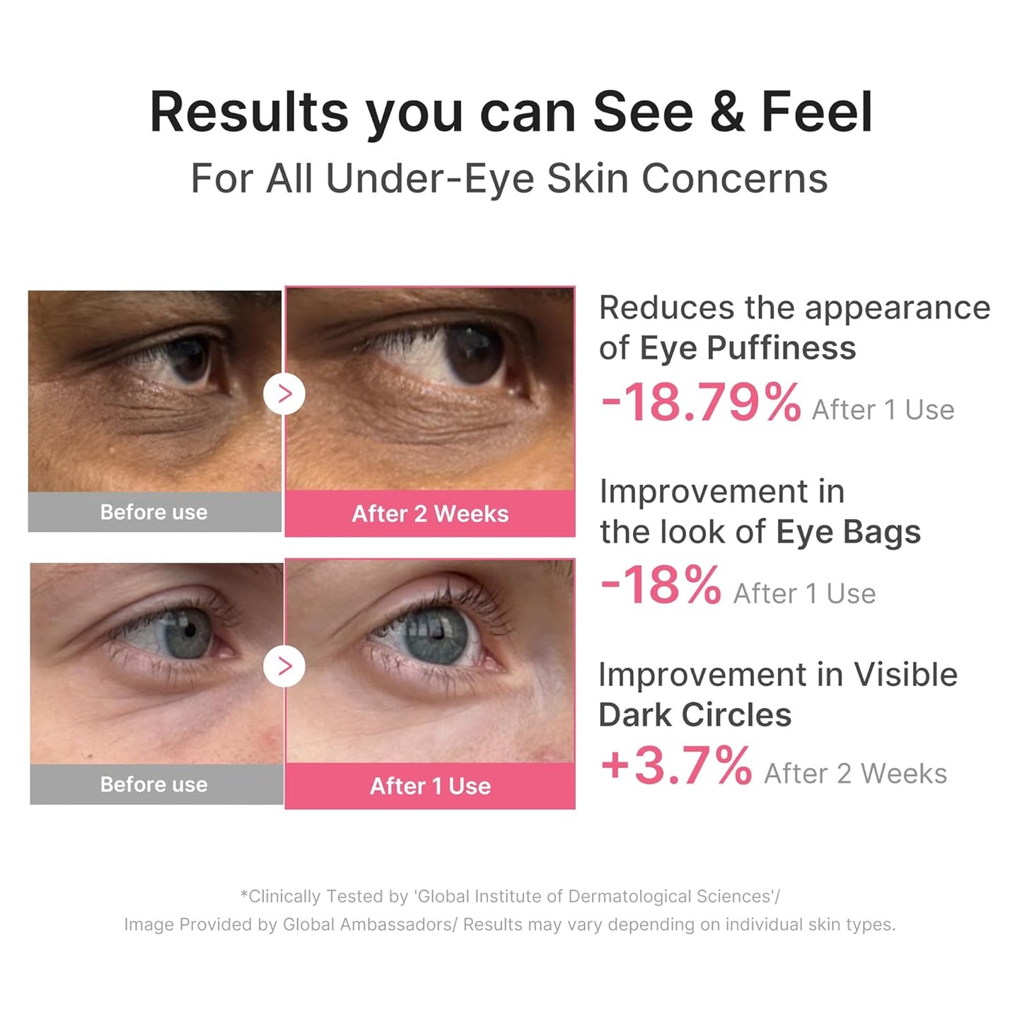 HOTmedicube Eye Patch PDRN Caffeine Collagen | Gel Eye Patches for the appearance of Dark Circles, Undereye Bags | Firming, Age-Defying Care with Retinol, Collagen | Korean Skincare | 30 Pairs