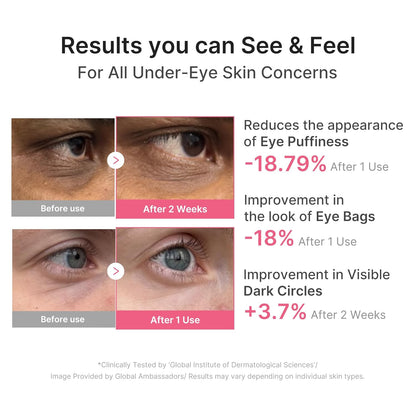HOTmedicube Eye Patch PDRN Caffeine Collagen | Gel Eye Patches for the appearance of Dark Circles, Undereye Bags | Firming, Age-Defying Care with Retinol, Collagen | Korean Skincare | 30 Pairs