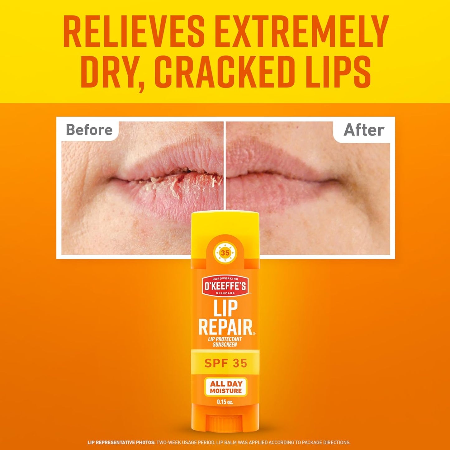 HOTO'Keeffe's Lip Repair SPF 35 Lip Balm - Stick (3 Pack) - Sun-Safe Moisturizer for Extremely Cracked, Dry Lips