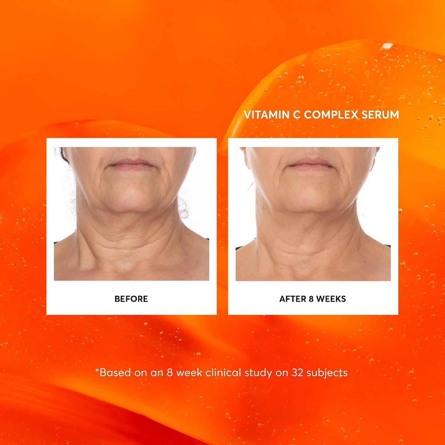 HOTNaturium Vitamin C Complex Face Serum, Plus Hyaluronic Acid & Vitamin E, Anti Aging Skin Care Treatment, 1 oz