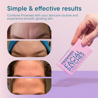 HOTFrownies Forehead and Between the Eyes Wrinkle Patches - Hypoallergenic Facial Patches to Smooth & Soften Forehead Wrinkles & Eleven Lines - For Overnight Use, 144 Patches | Overnight Patches for Forehead & 11 Lines