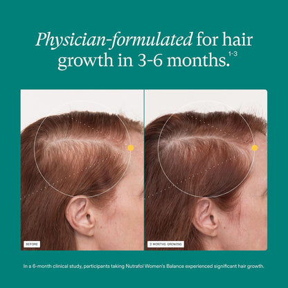 HOTWomen's Balance Hair Growth Supplements, Ages 45 and Up, Clinically Tested for Visibly Thicker Hair and Scalp Coverage, Dermatologist Recommended - 1 Month Supply