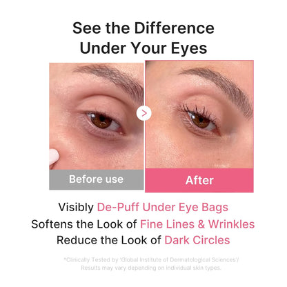 HOTmedicube Jelly Eye Mask PDRN Pink Collagen | Hydrogel Eye Patches with PDRN, Collagen, NAD | Refreshing for Puffy, Tired Eyes | Firming for Look of Wrinkles, Fine Lines | Korean Skincare (28 Pairs)