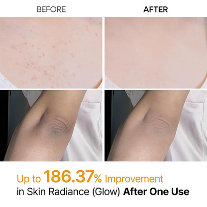 HOTDr.Melaxin Peel Shot Kojic Acid Turmeric Body Exfoliator Spray 6.76 fl.oz - AHA PHA Niacinamide Body Scrub for KP Bumps, Dark Spots, Uneven Skin Tone, Dead Skin, Korean Skin Care