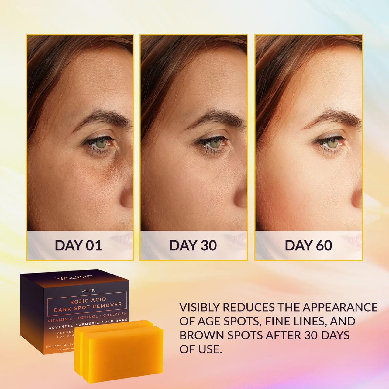 HOTVALITIC Kojic Acid Dark Spot Remover Soap Bars with Vitamin C, Retinol, Collagen, Turmeric - Original Japanese Complex Infused with Hyaluronic Acid, Vitamin E, Shea Butter, Castile Olive Oil (2 Pack)