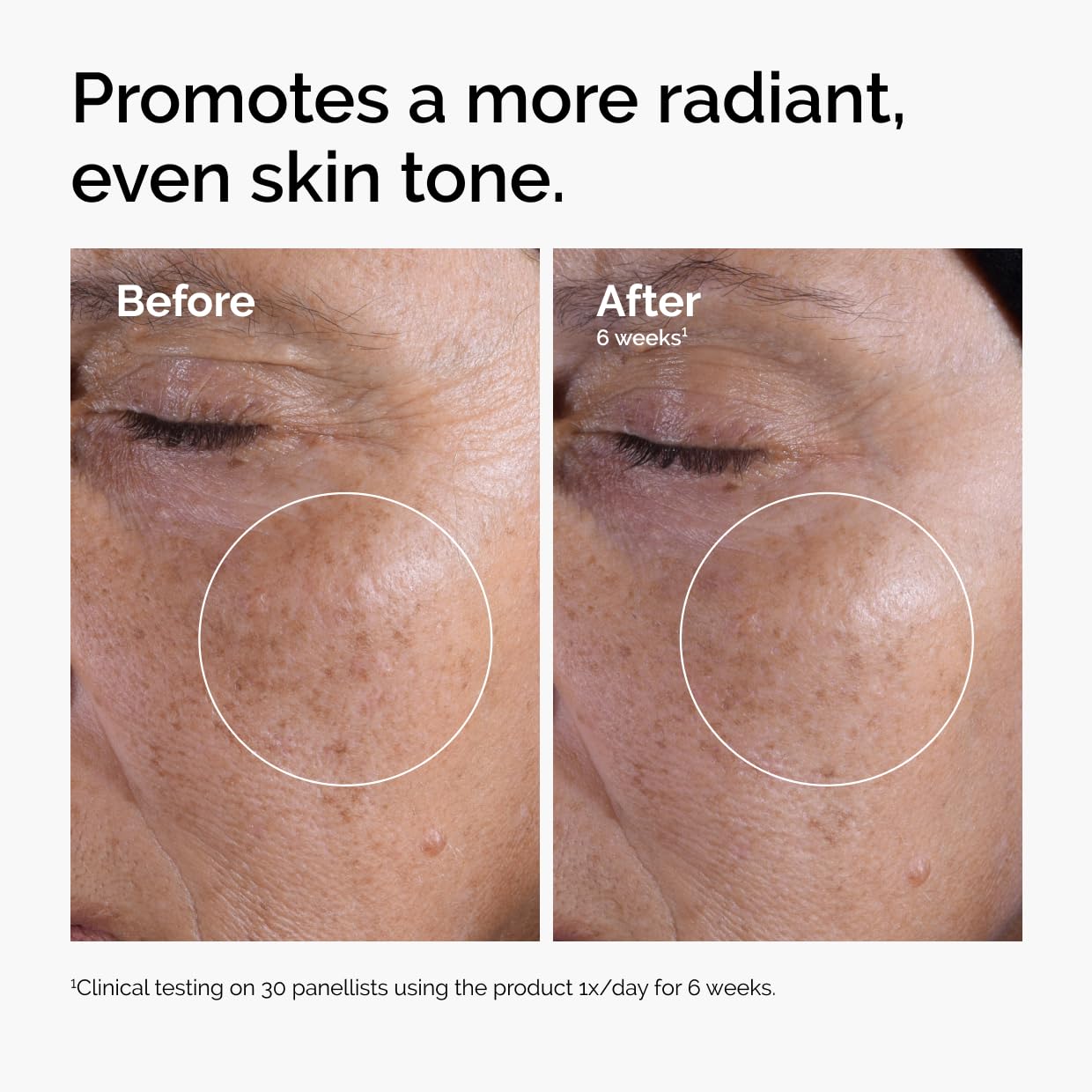 HOTThe Ordinary Glycolic Acid 7% Exfoliating Toner, Brightening and Smoothing Daily Toner for More Even-Looking Skin Tone
