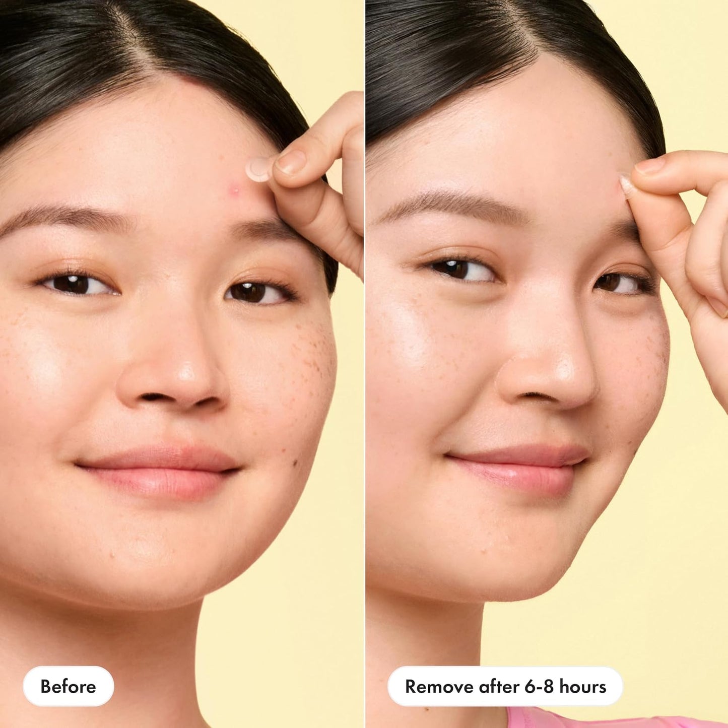 HOTHero Cosmetics Mighty Patch Mini Invisible+ Acne Pimple Patches, 30 Ct | X-Small 10mm, Daytime Hydrocolloid Acne Patches, for Covering Zits & Blemishes, Blends Into Skin & Barely There