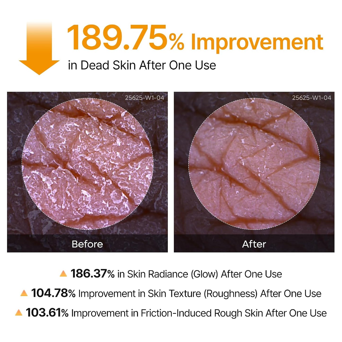 HOTDr.Melaxin Peel Shot Kojic Acid Turmeric Body Exfoliator Spray 6.76 fl.oz - AHA PHA Niacinamide Body Scrub for KP Bumps, Dark Spots, Uneven Skin Tone, Dead Skin, Korean Skin Care