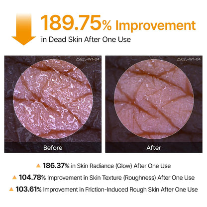 HOTDr.Melaxin Peel Shot Kojic Acid Turmeric Body Exfoliator Spray 6.76 fl.oz - AHA PHA Niacinamide Body Scrub for KP Bumps, Dark Spots, Uneven Skin Tone, Dead Skin, Korean Skin Care