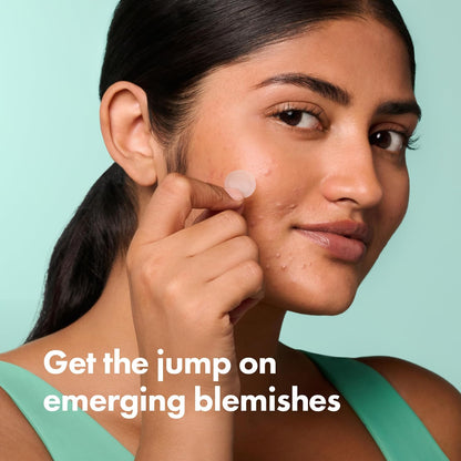 HOTMighty Patch Hero Cosmetics Micropoint Acne Pimple Patches, 8 Ct | For Early Stage Zits & Hidden Blemishes; Hydrocolloid with Salicylic Acid, Niacinamide, Cica; 395 Micropoints; Acne Stickers